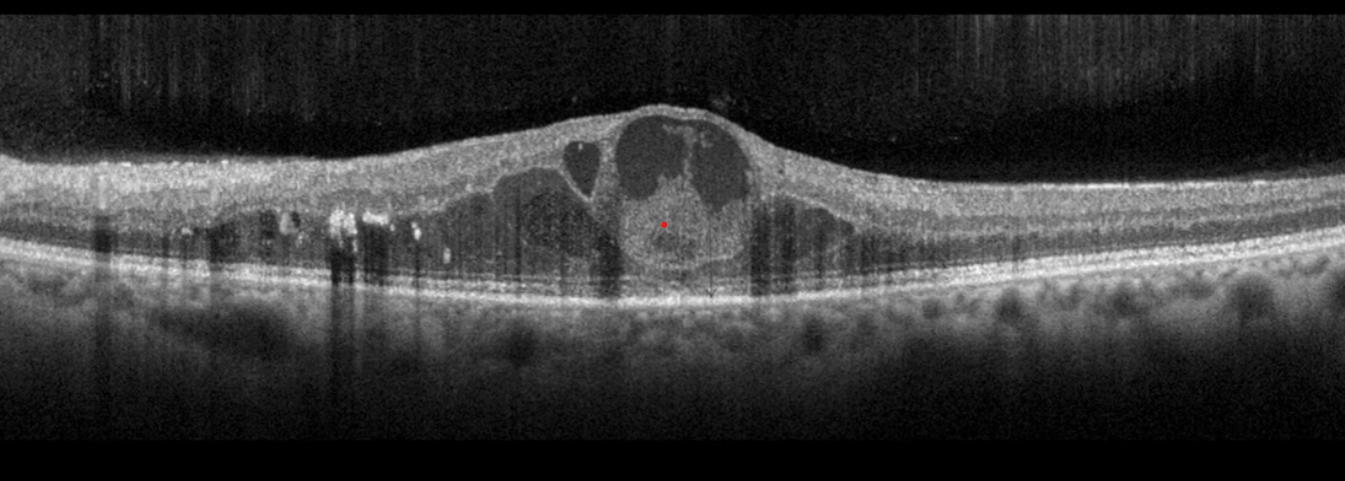 Read more about the article Keeping an eye on the eyes