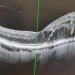 Blood, feet and eyes