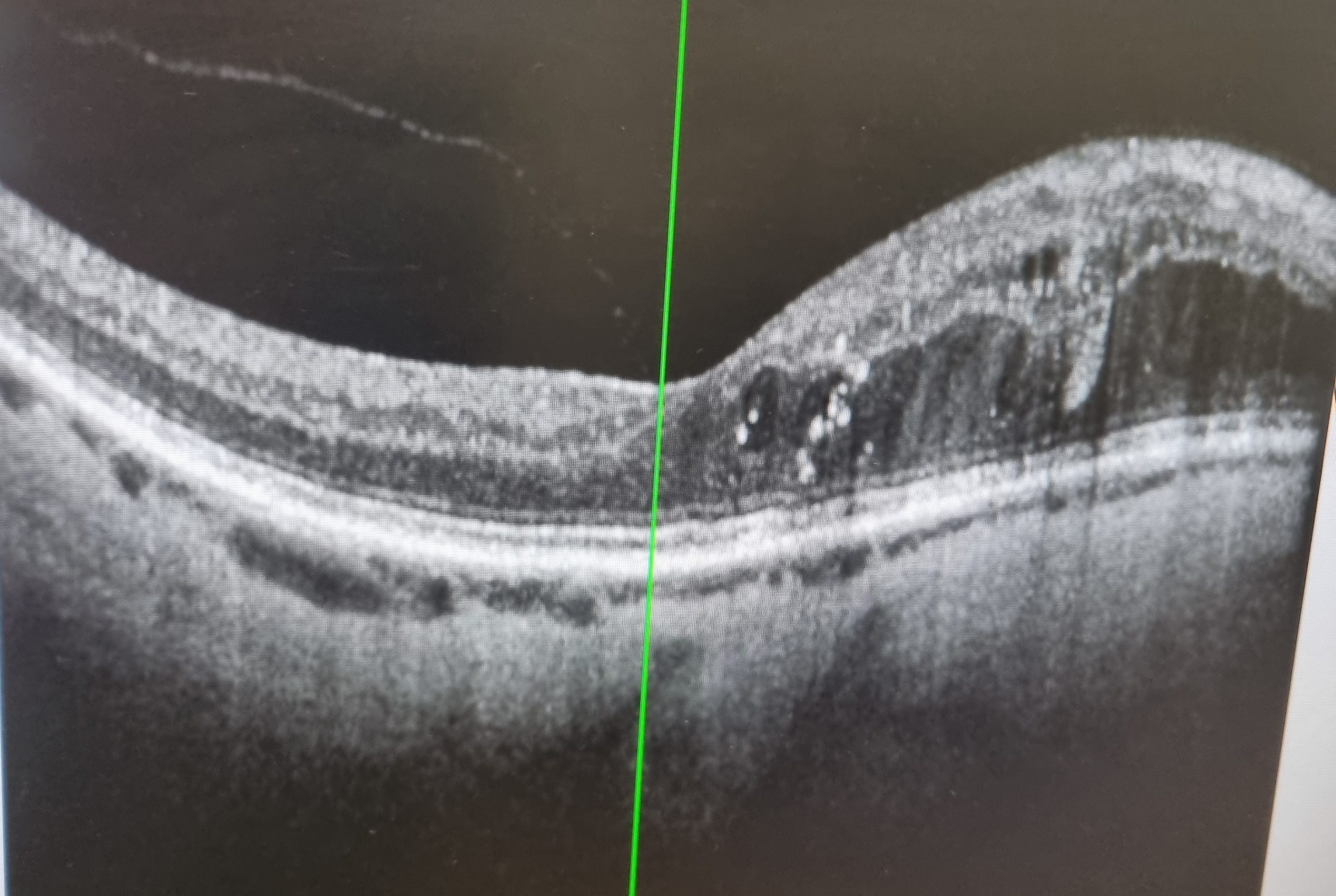 You are currently viewing Blood, feet and eyes